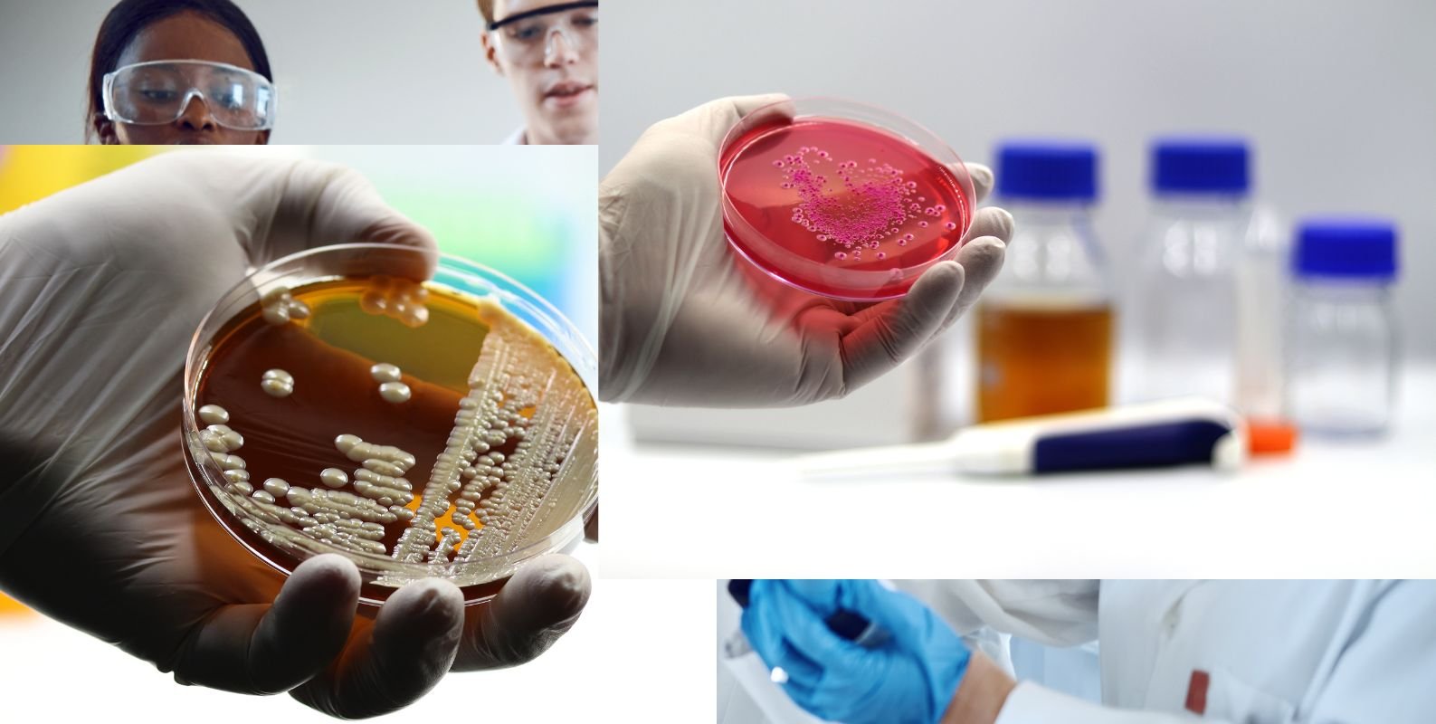 Probiotics and Digestion