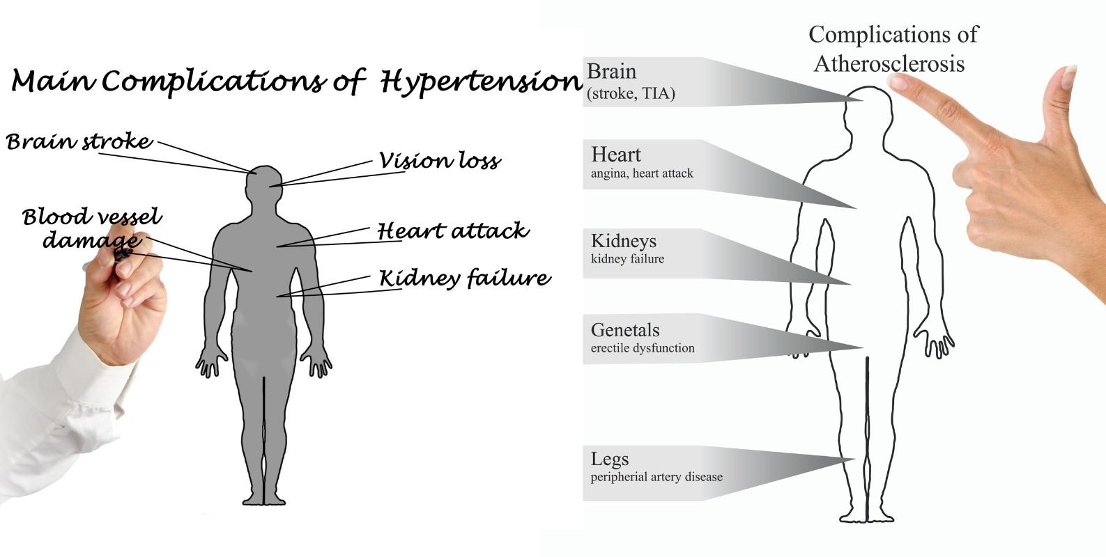 Managing Type 2 Diabetes